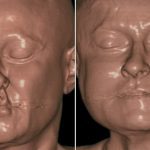 бръчки от спане гримландия