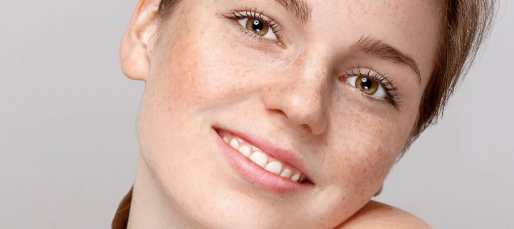 10 начина да се отървете от луничките по лицето бързо и естествено